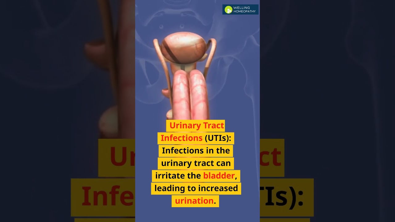 Причины учащенного мочеиспускания и варианты лечения