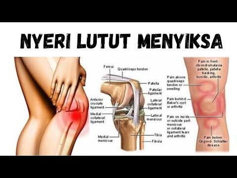 Video: Yang Menyebabkan Nyeri Di Bawah Lutut