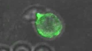 First Ever Video Reveals How HIV Spreads Between Immune Cells The Body