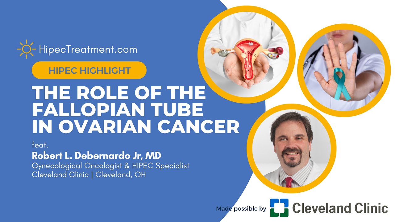 The Fallopian Tube's Role in Ovarian Cancer | HIPEC Highlight | HipecTreatment.com