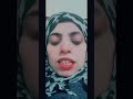 مرض مزمن حكمه جميله عبره جديده يا جمال حكمتي مرض مزمن حكمه جميله عبره جديده يا جمال حكمتي
