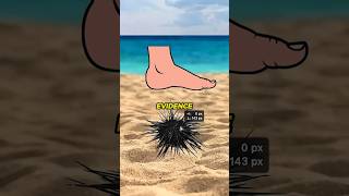 Look Before Jump| It's Sea Urchin