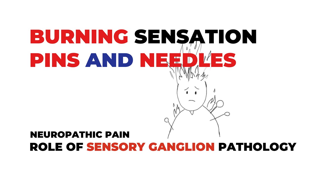 Neuropathic Pain Burning Sensations Pins And Needles YouTube