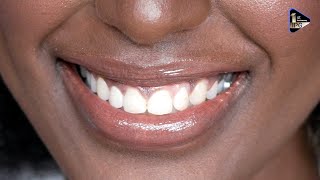 Stronger Smiles - Brighter Smiles with IPG