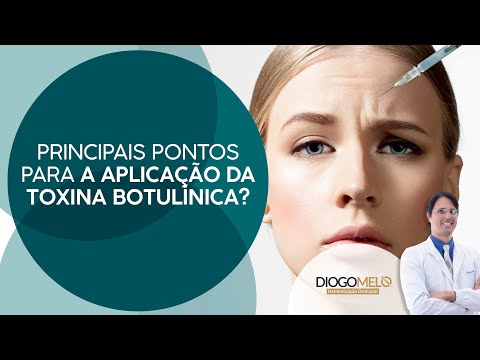 Pontos de aplicação da toxina botulínica, porque personalizar?