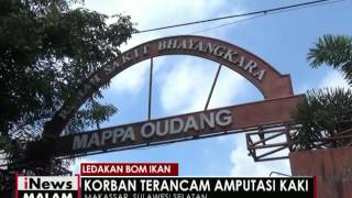 Salah satu korban ledakan bom ikan di Makassar terancam kakinya diamputasi - iNews Malam 18/05