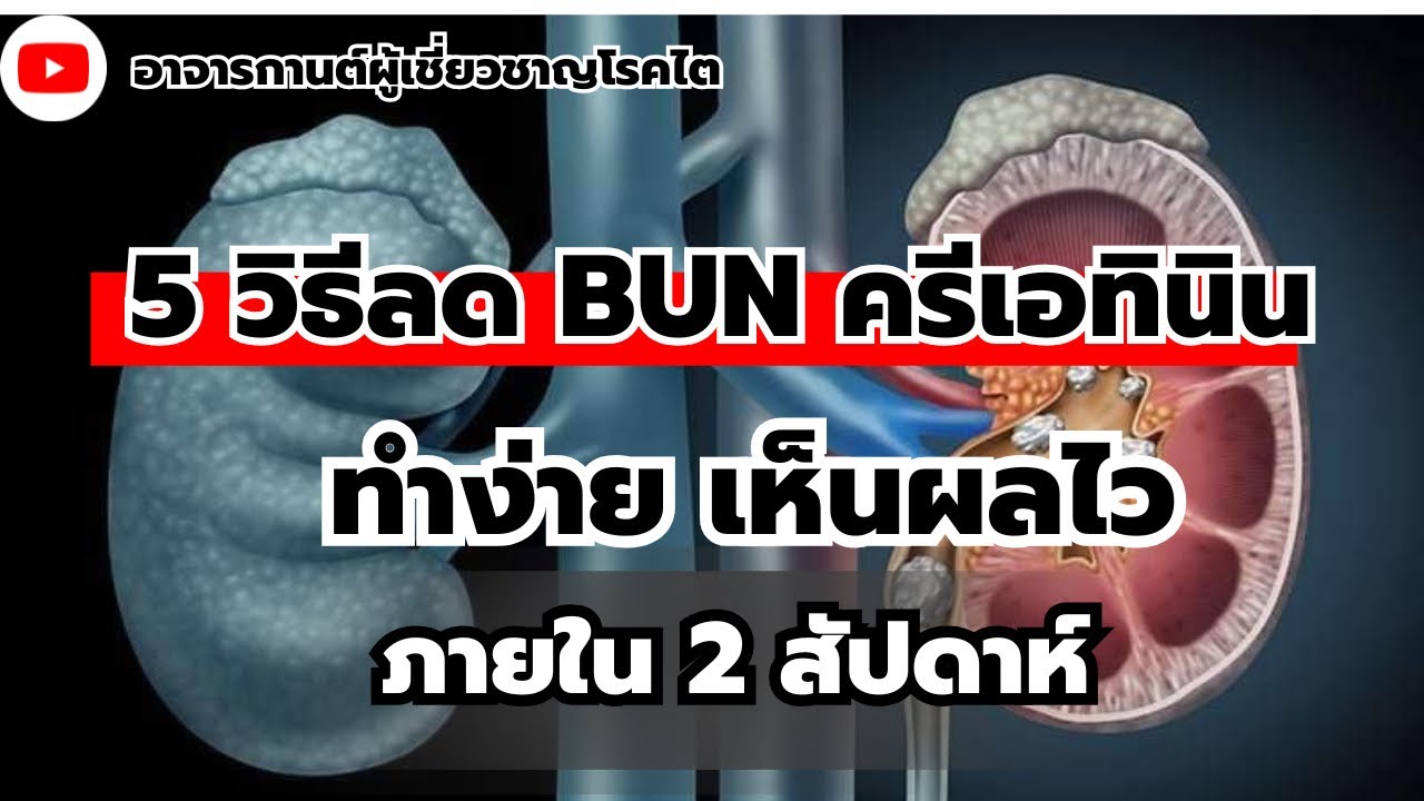 5 วิธีลดbun ครีเอทินิน แบบทำง่ายและได้ผลจริง |โรคไต |ไตวาย|อาจารย์กานต์