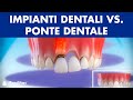 Impianti dentali vs. Ponte dentale – Confronto ©