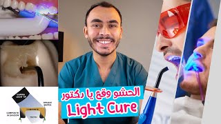 7 حاجات تاخد بالك منهم مع الـ Light Cure