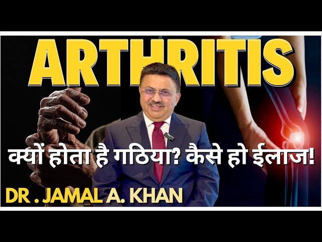 Understanding Arthritis: Causes and Treatment | Dr. Jamal A Khan class=