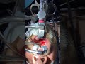 Peritonsiller abscess