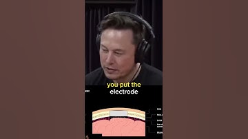 Elon Musk on Neuralink Implant 🧠