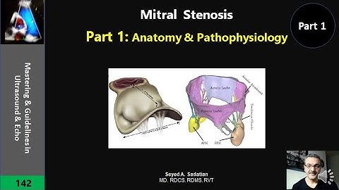 Mitral Stenosis Part 1: Anatomy & Pathophysiology