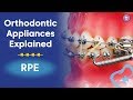 Orthodontic Appliances Explained | RPE