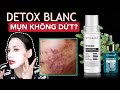 DETOX BLANC | Cam kết trị sạch mụn, trắng da sau 7 ngày? BẠN ƠI ĐỪNG XẠO NỮA !!!