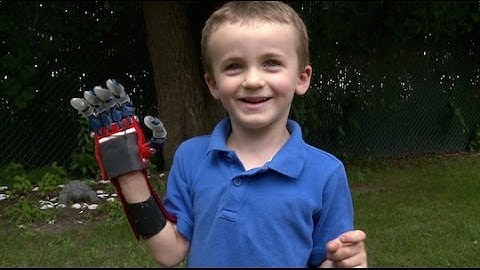 Kid Engineer: 3D-Printed Hand | Design Squad
