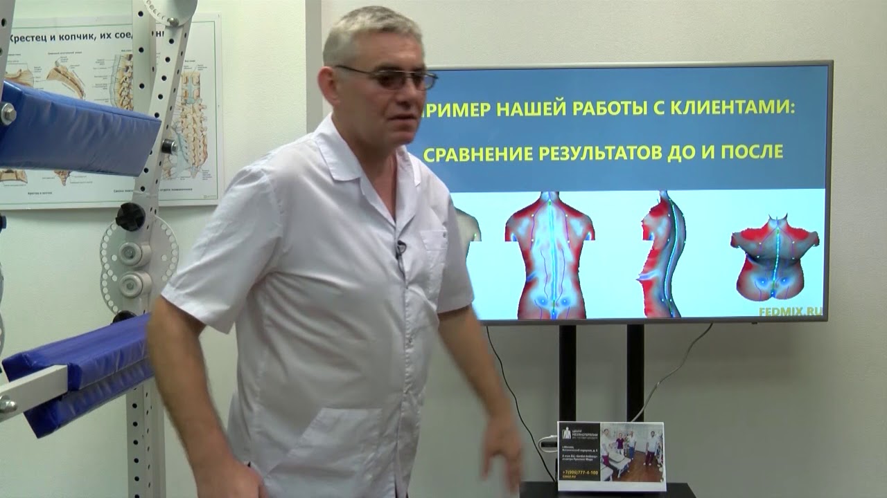 Что такое мышечный дисбаланс и что с ним делать