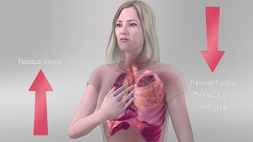 Overview of InterVapor Bronchoscopic Thermal Vapor Ablation (BTVA)