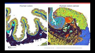 MSS April 29, 2024 - Leilani Marty-Santos, Ph.D.Spatial Science and Technology Advisor, 10xGenomics