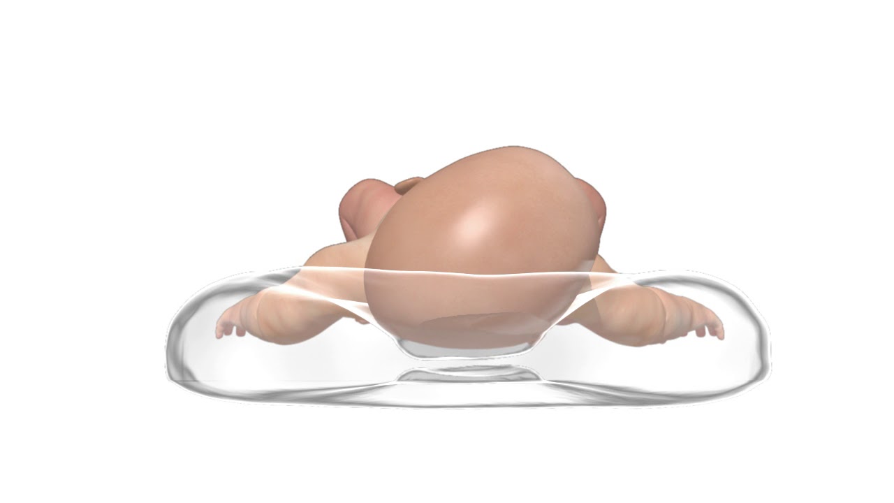 Cojín Mimos - qué es y cómo funciona