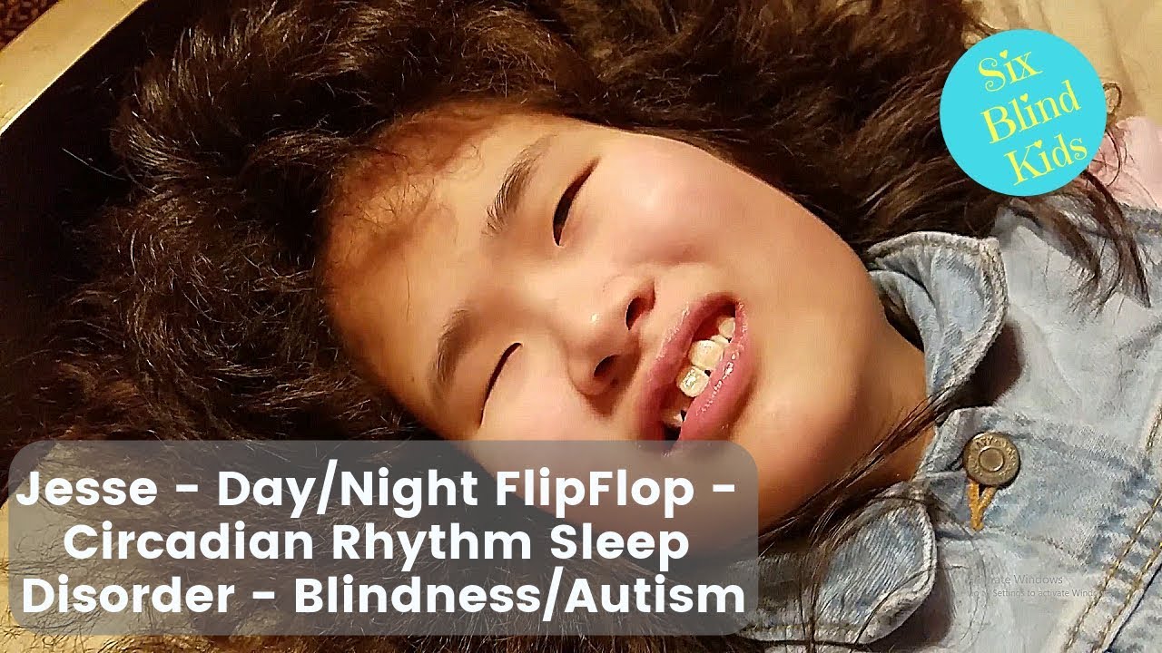 Jesse And Her Day/Night FlipFlop Circadian Rhythm Sleep Disorder