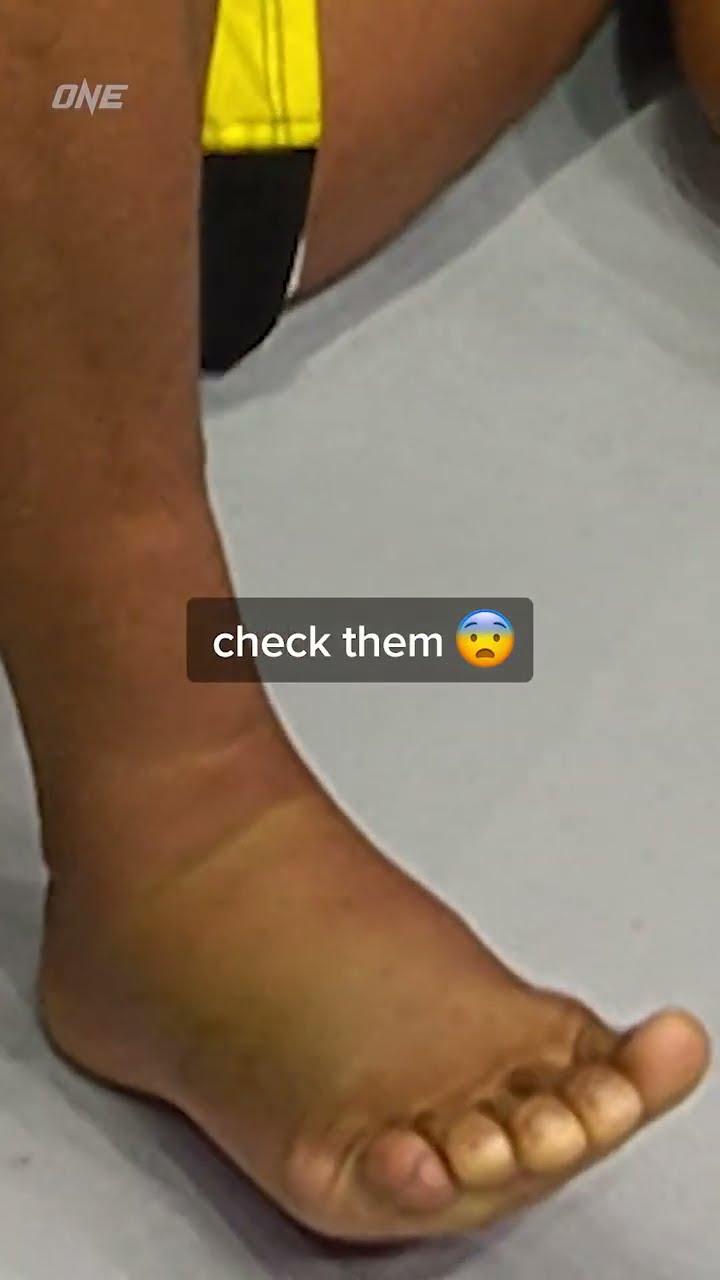 These kicks aren't for the faint of heart ?