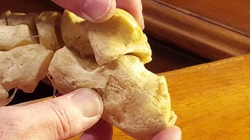 Subtalar Joint Range of Motion With Foot Skeleton