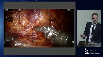 Robotic Pyeloplasty by Jonathan Harper, MD
