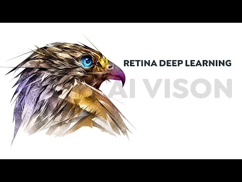 Quality Control with AI Vision | RETINA DEEP LEARNING Software | CHROMOS Industrial