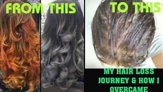My Hair loss journey| How i got my hair back
