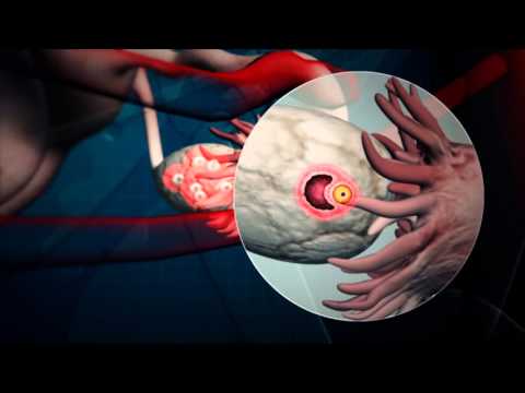 რეპროარტი