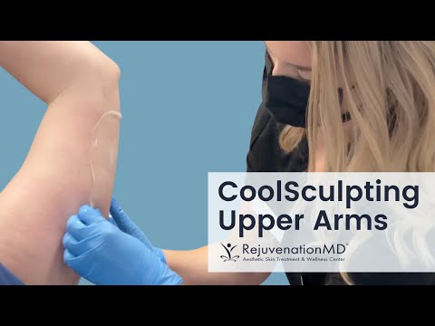 CoolSculpting Upper Arm Fat