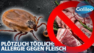 Ein einziger Biss kann zum Tod führen? Leben mit der Allergie gegen Fleisch!