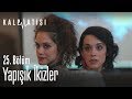 Herkesi şok eden yapışık ikizler - Kalp Atışı 25. Bölüm