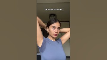 The Dermadry difference ☀️ Your solution for sweaty underarms! 💦