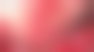 Clip reconstruction of pericallosal artery aneurysm adherent to falx cerebri