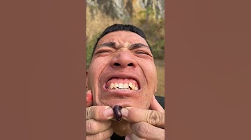 How I Cured a Bug Bite with Yogurt in the Wild | Survival Hacks