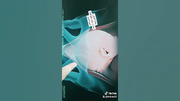 عنق الرحم يفتح بسبب الطلق وهو انقباض عضلة الرحم لدفع الجنين للخارج 