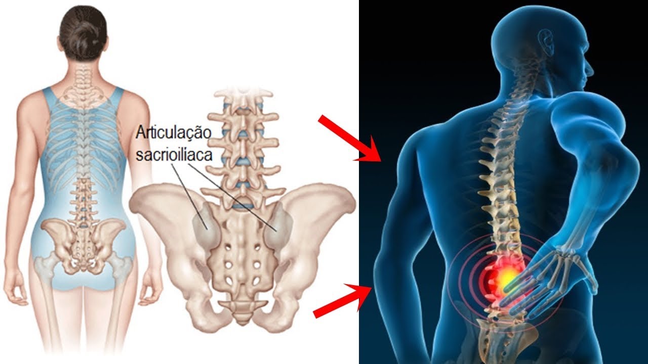 😫 Muita Dor na Bacia?! Conheça Novo Método que Acaba com a Dor na Bacia