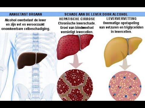 Gevolgen van alcohol