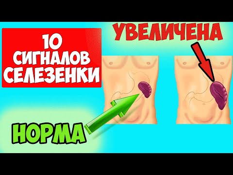 10 тревожных сигналов о том что нужно лечить СЕЛЕЗЕНКУ