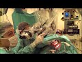 Guevara chirurgie implant cochlaire  cochlear implant surgery nice