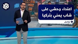 بسبب خلاف مع صبي تركي.. اعتداء وحشي على طفل يمني في اسطنبول يشعل مواقع التواصل