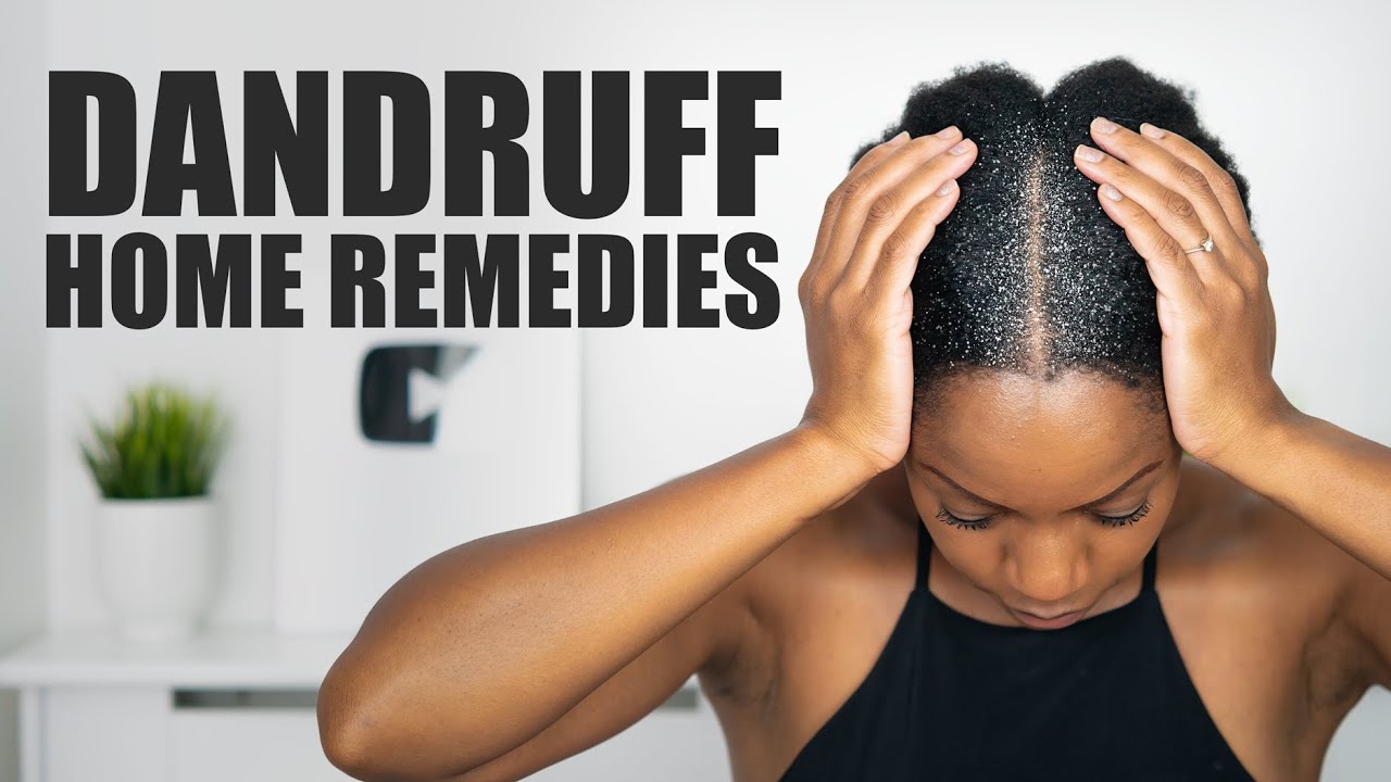 6 home remedies for dandruff and hair fall in winter