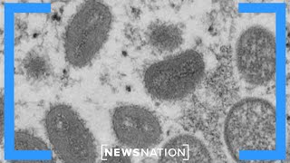 U.S. records first monkeypox death, cases declining | NewsNation Prime