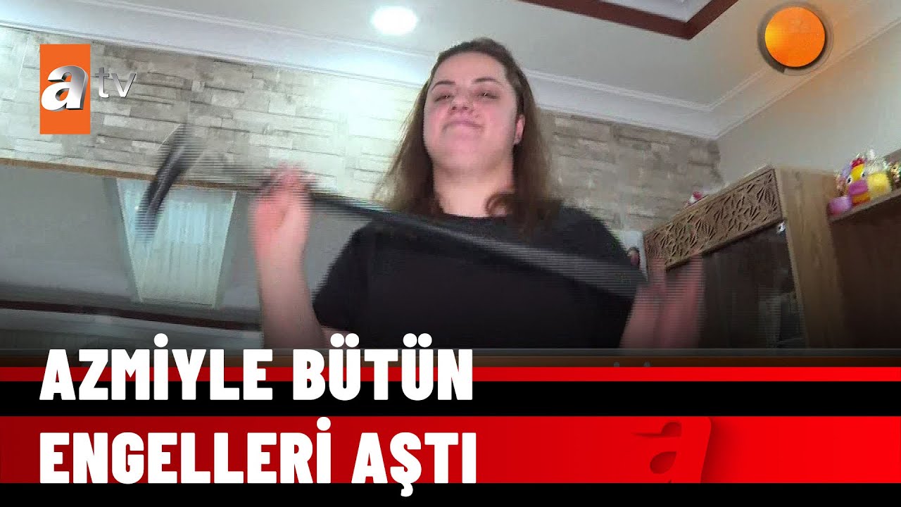 SCA ile 28 yıldır mücadele ediyor - atv Haber 7 Şubat 2022