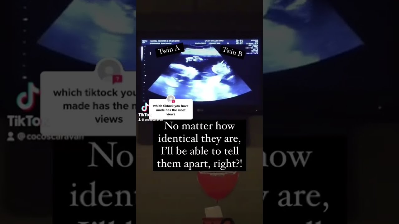 do-my-identical-twins-look-alike-youtube