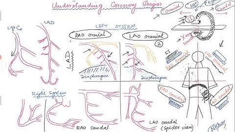 Basics of angiographic views during left heart catheterization