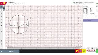 Qué es el SEMA de SCHILLER y como funciona #sema screenshot 4