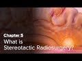 What is Stereotactic Radiosurgery? Chapter 5 — Brain Metastases: A Documentary